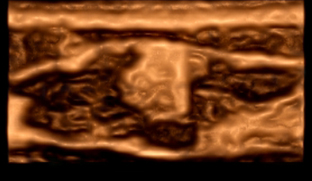 正常乳線の縦断面超音波像