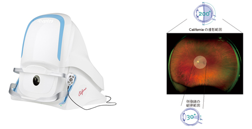 眼底検査（オプトス）