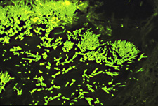 蛍光抗体法によるアスペルギルスの証明